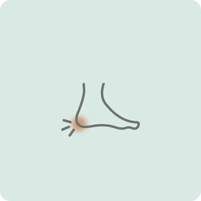 Fascitis Plantar
