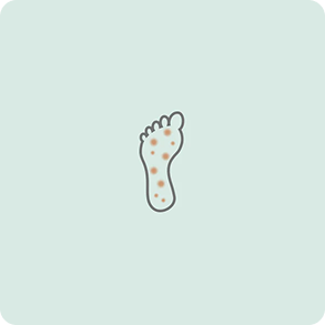 Neuropatía