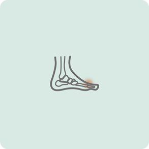 Artritis